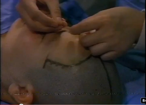 Chinese Medicine Classic TV Program (Qi, etc… )